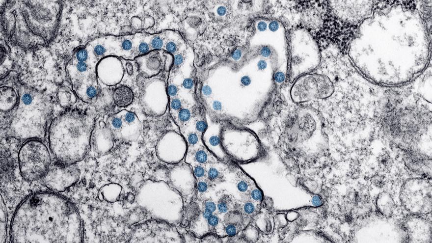 Archivo - Partículas del virus SARS-CoV-2, coloreadas en azul, en una imagen de microscopio de electrones. /