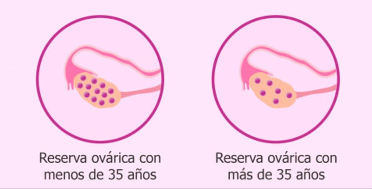 ¿Cómo programar la maternidad? Conoce tu reserva ovárica y preserva tu fertilidad