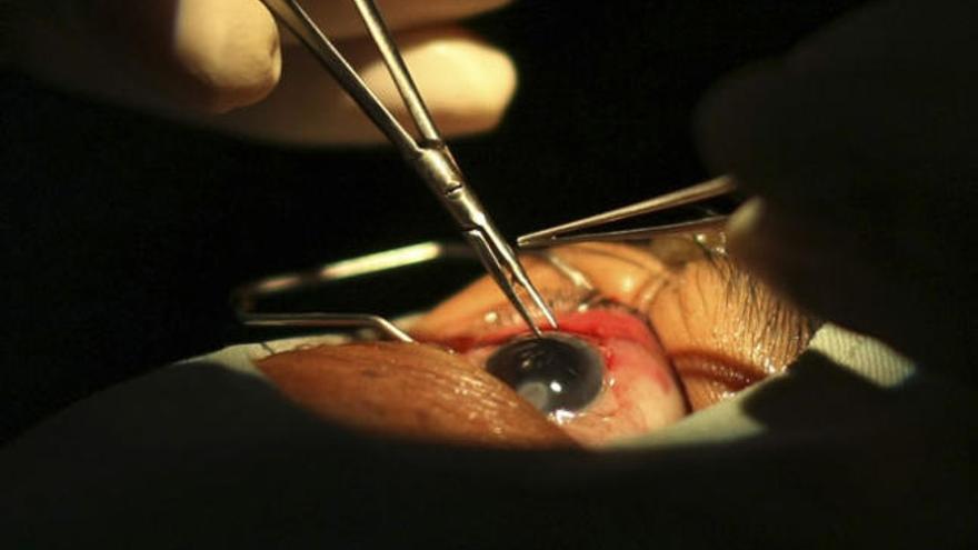 La esviación de los ojos puede operarse a cualquier edad