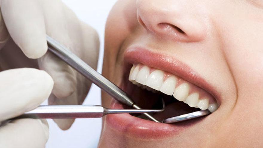 La limpieza dental es el complemento ideal del cepillado diario.