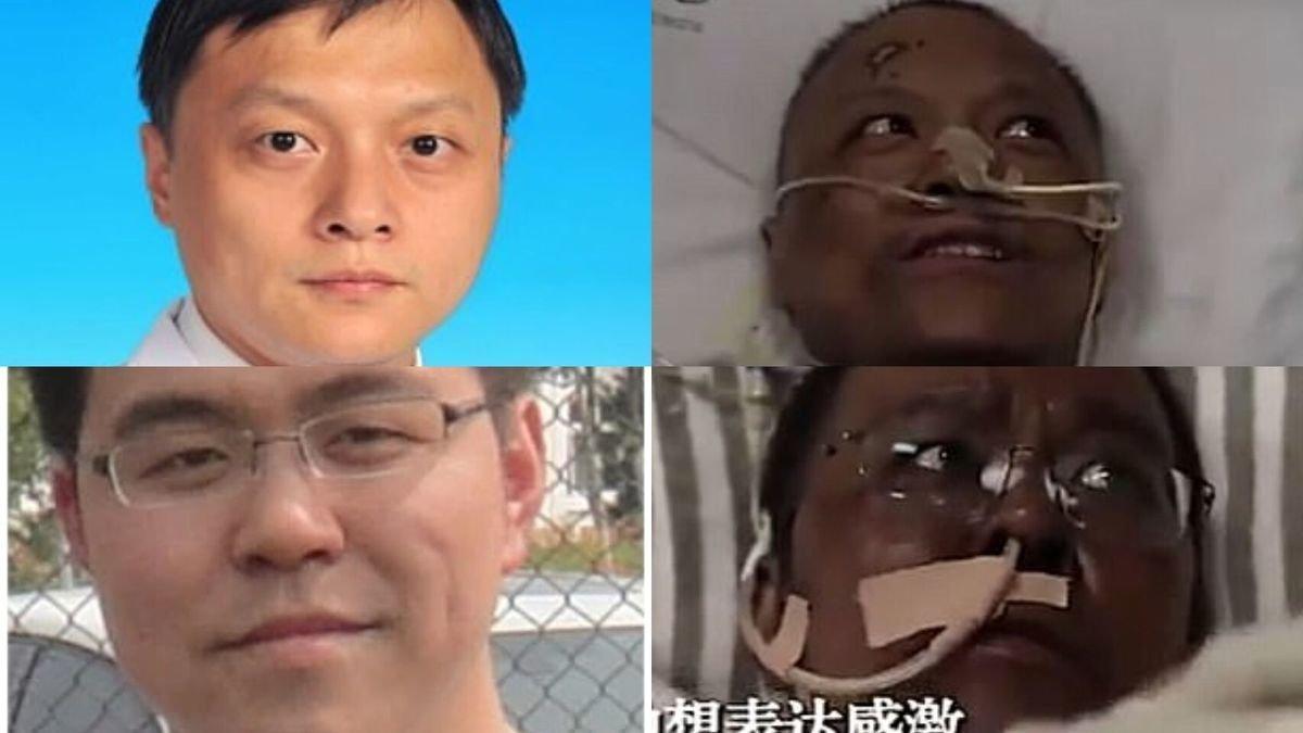 Los médicos Yi Fan (arriba) y Hu Weifeng, antes y después de someterse al tratamiento contra el coronavirus