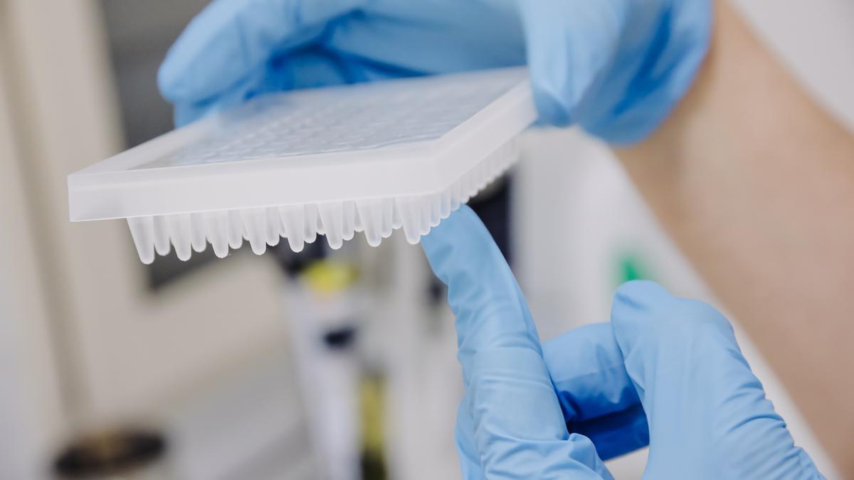 Una enfermera prepara una PCR para el análisis de la viruela del mono.