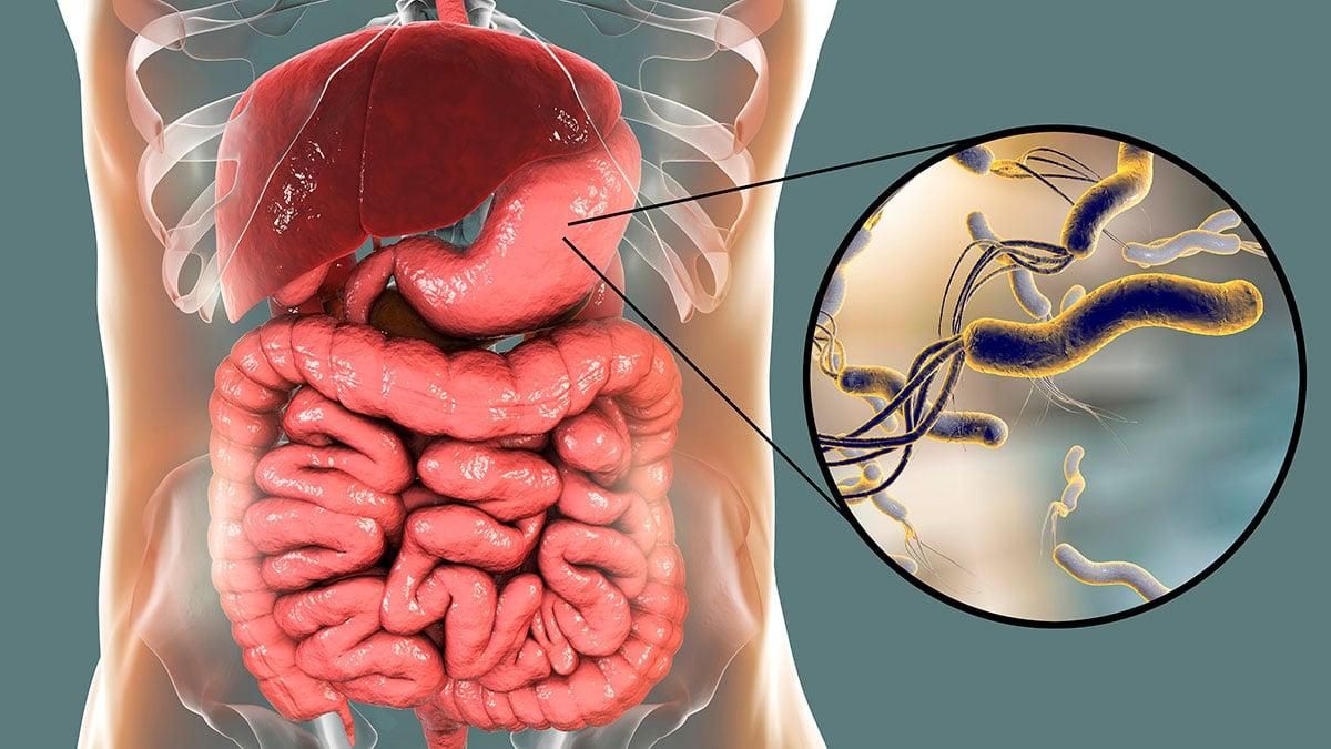 Helicobacter: la infecció silenciosa que afecta la meitat de la població mundial.