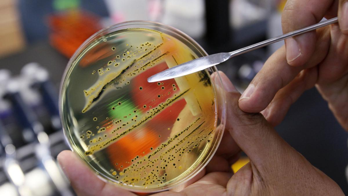 La bacteria de la salmonela, en un laboratorio de Estados Unidos.