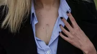 Las interesantes cifras que deja Alicante en donación de órganos