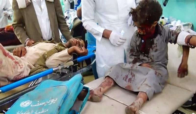 29 niños muertos en un bombardeo en Yemen
