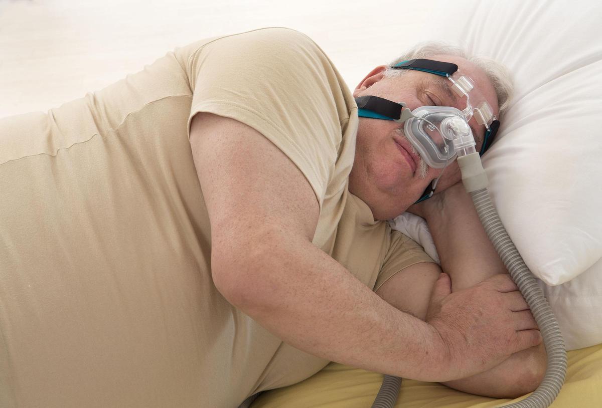 Cirugía contra la apnea del sueño: el Hospital del Mar realiza una