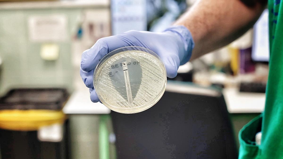 Imagen de un test epsilon antibiograma que muestra a cuánta concentración de antibiótico es resistente la bacteria