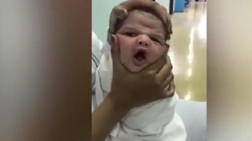 Despedidas tres enfermeras por deformar las cabezas de recién nacidos