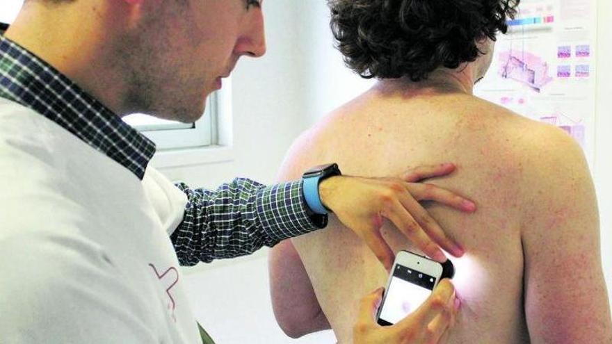 Los dermatólogos diagnostican cada día un melanoma en la Región de Murcia