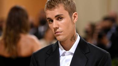 El motivo por el que Justin Bieber tiene media cara paralizada