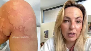 Lucía Galán, pediatra: "Asusta, pero la inmensa mayoría de veces no es grave; ¿cómo actuar?"