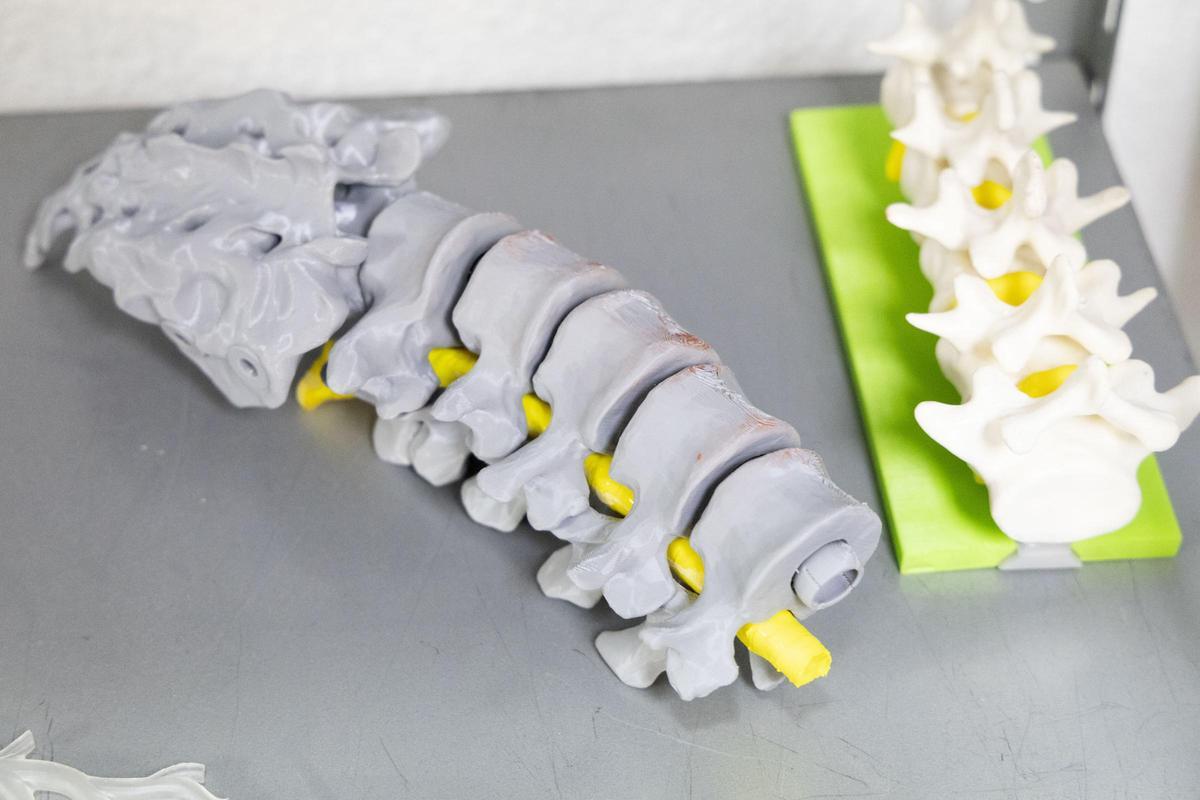 Alicante exporta a Europa prototipos en 3D del cerebro