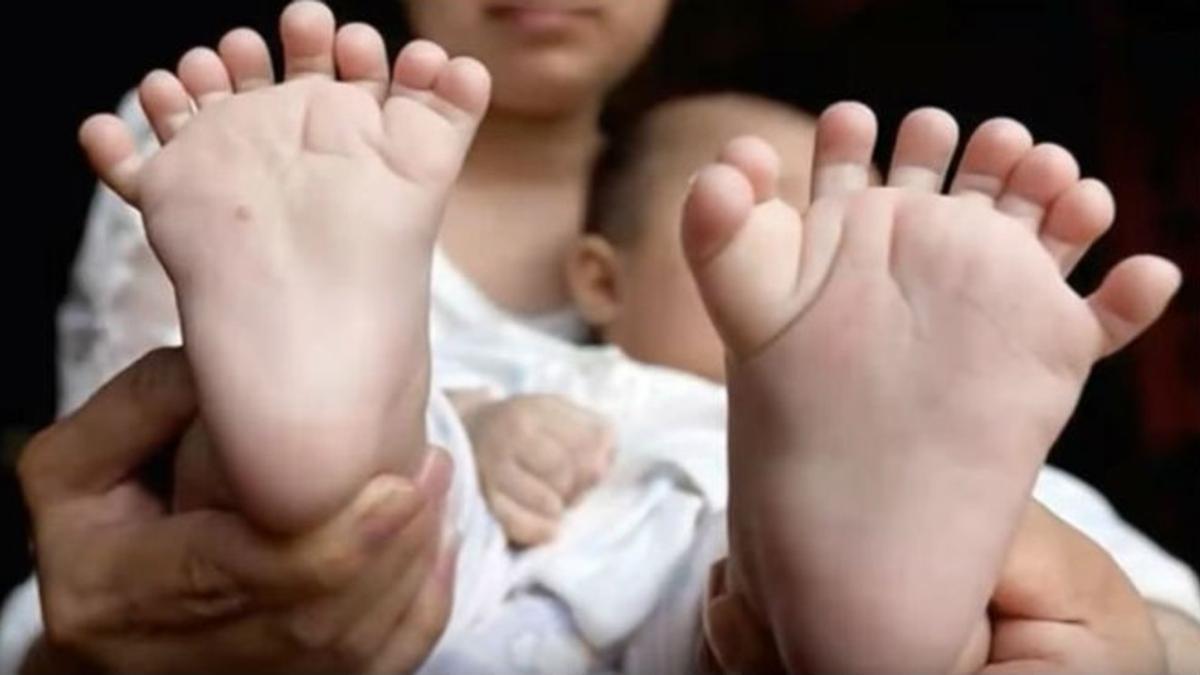La madre de Hong Hong muestra los pies del bebé, con ocho dedos cada uno.