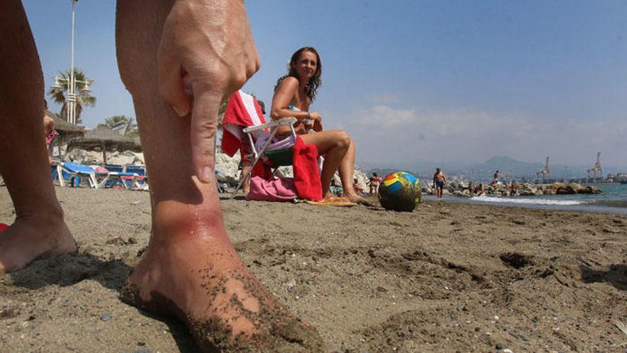 Un bañista muestra de las picaduras en la playa de la Misericordia.