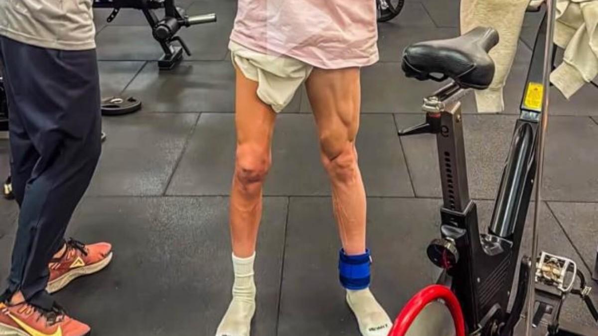 Estado de la rodilla de Riqui Puig