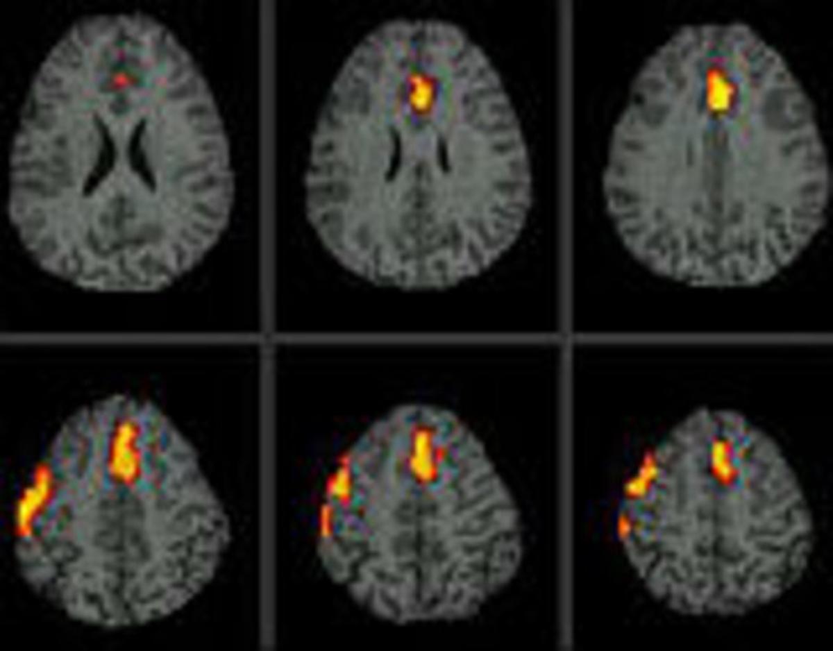 Els artistes tenen una estructural cerebral diferent. Els artistes tenen una estructural cerebral diferent.