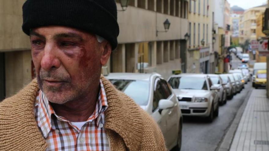 Luis Martín, taxista de Badajoz agredido: &quot;Se cebó dándome golpes con una barra de hierro por todas partes&quot;