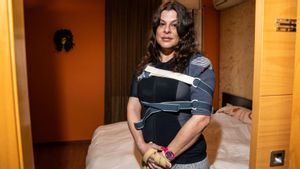 Els jutges concedeixen la invalidesa a una dona que pateix una malaltia rara