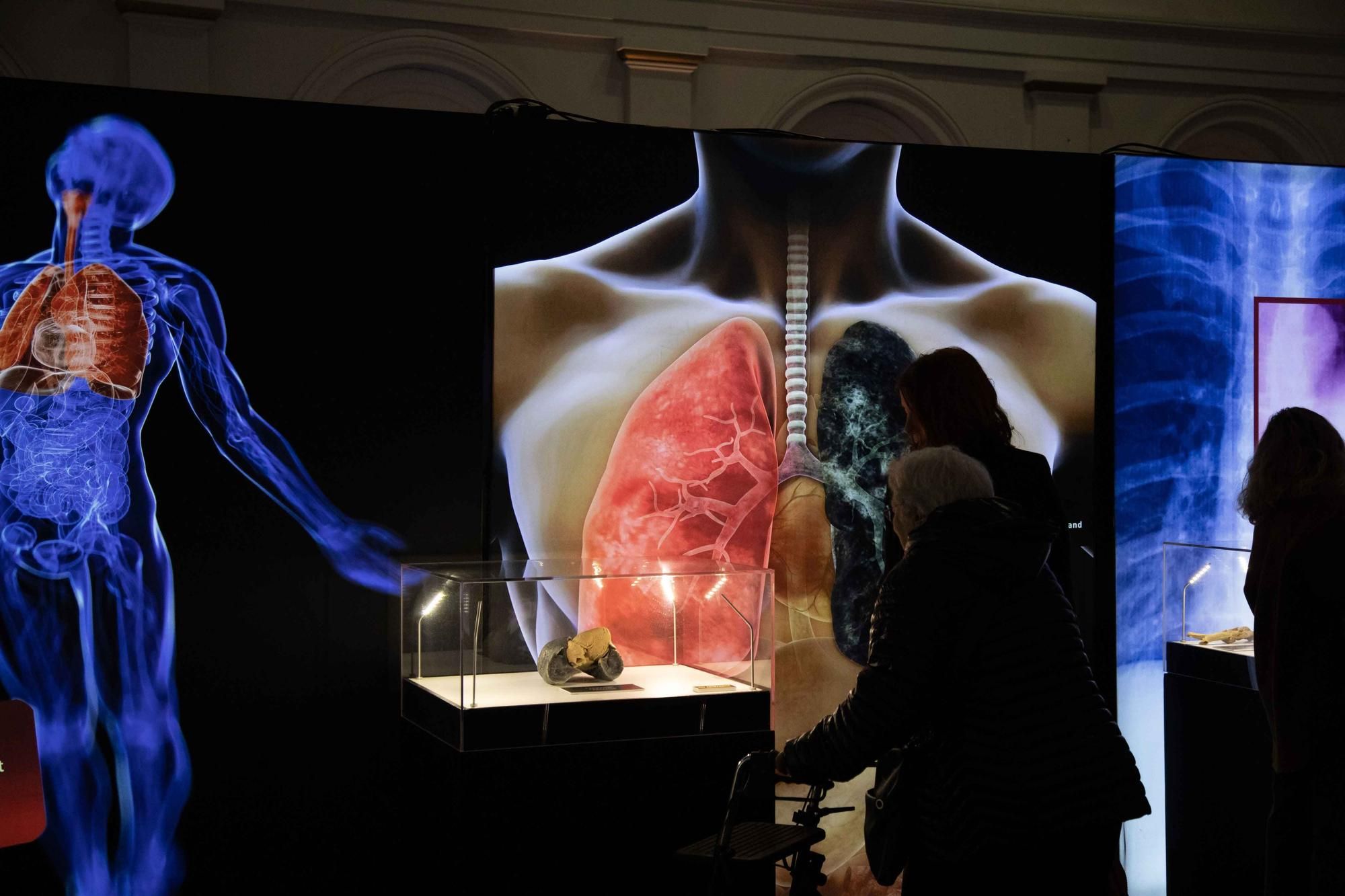 Präparierte menschliche Körper und Organe in der Ausstellung "Bodies" bewundern