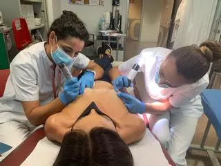 El Hospital del Vinalopó, primer centro que tatúa en 3D el pezón tras el cáncer de mama