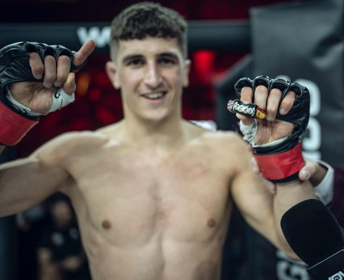 Liam Arjona enseña su bucal