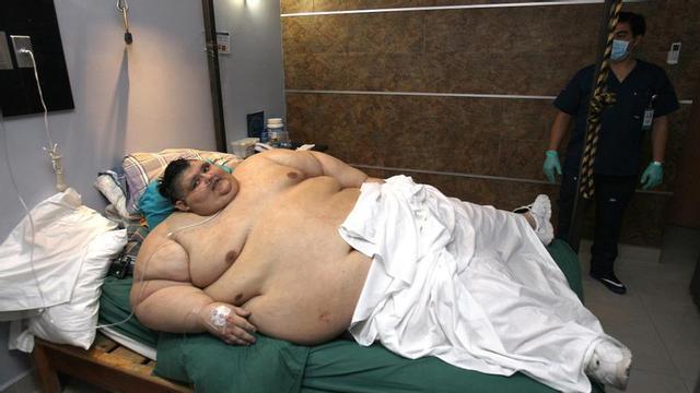 Muere el mexicano Juan Pedro Franco, conocido por haber sido el hombre más obeso del mundo.