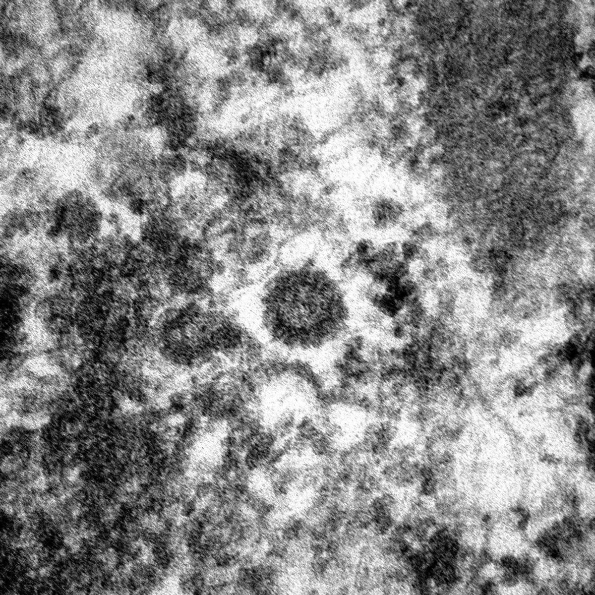 Micrografía electrónica del coronavirus hecha por el Servicio de Patología del Hospital del Mar.