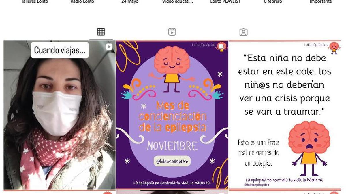 Una influencer divulga en redes para normalizar la epilepsia
