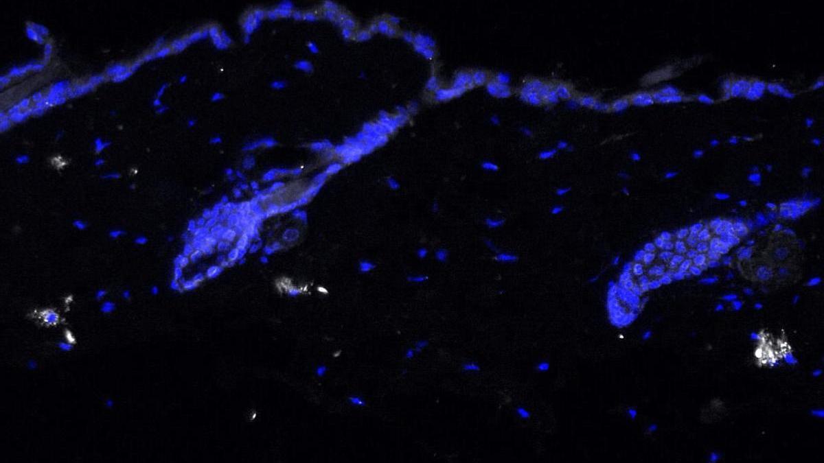Tinción de inmunofluorescencia de IL-17 (en blanco) en piel de ratón envejecido.