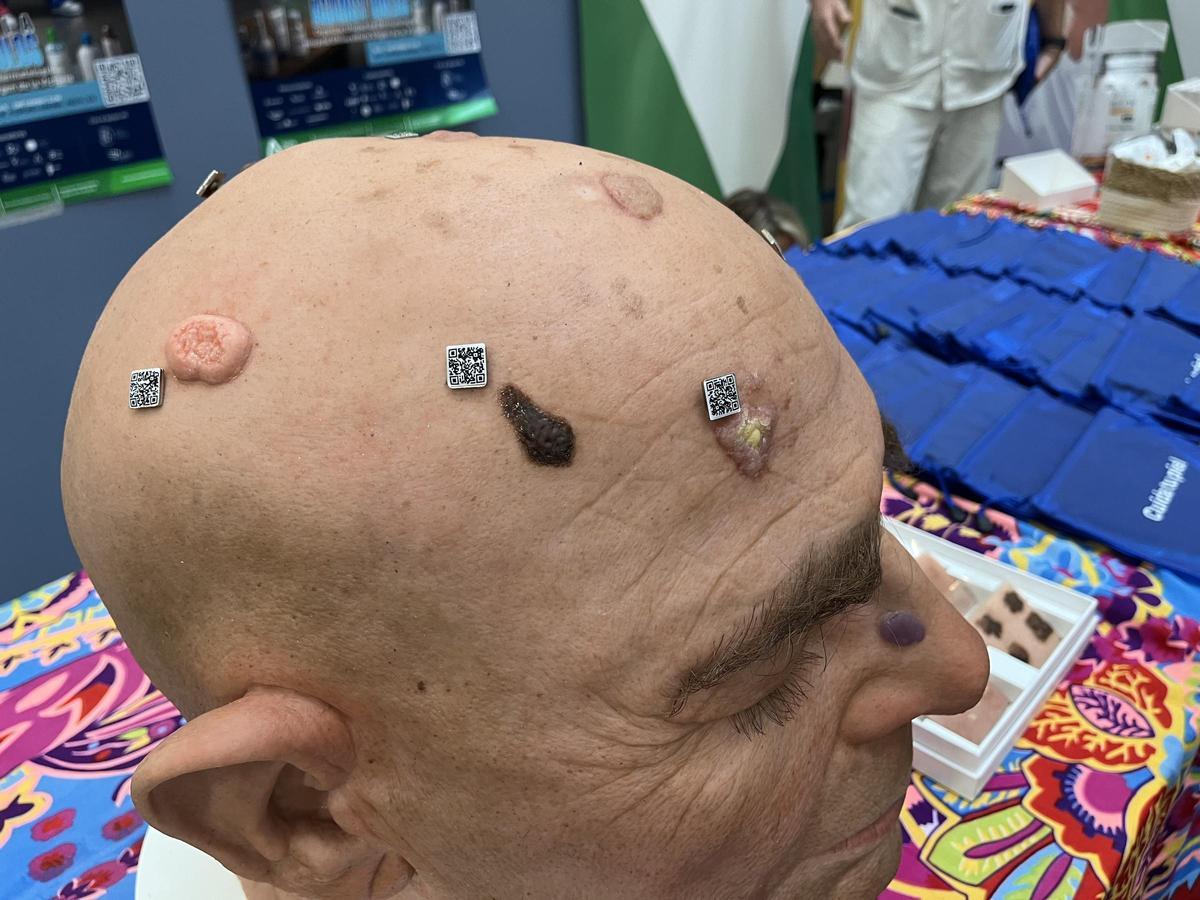 Un maniquí expuesto en el Hospital Clínico de Málaga con diferentes lesiones de la piel.