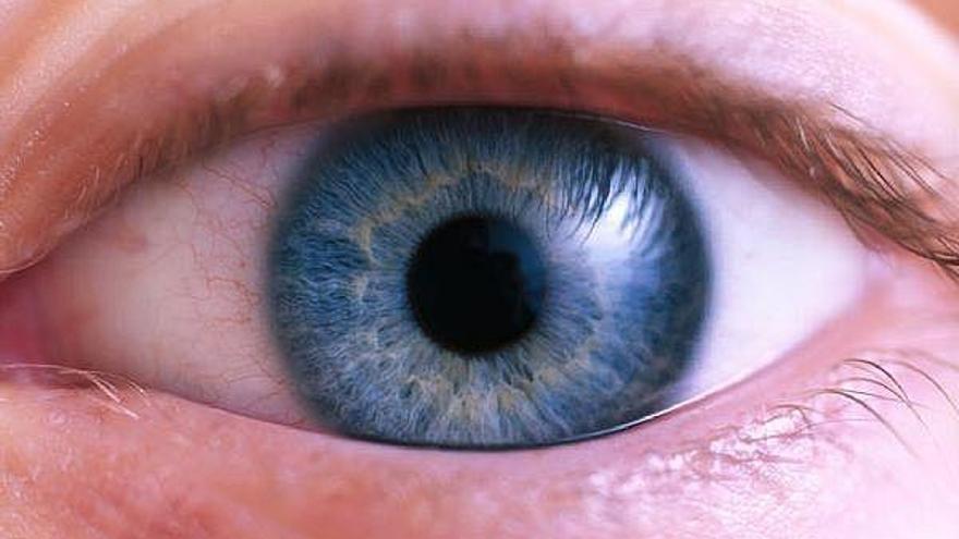 El glaucoma afecta al 6% de la población española