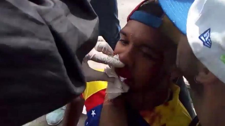 Willy Arteaga, el violinista venezolano, herido en Caracas por la Policía