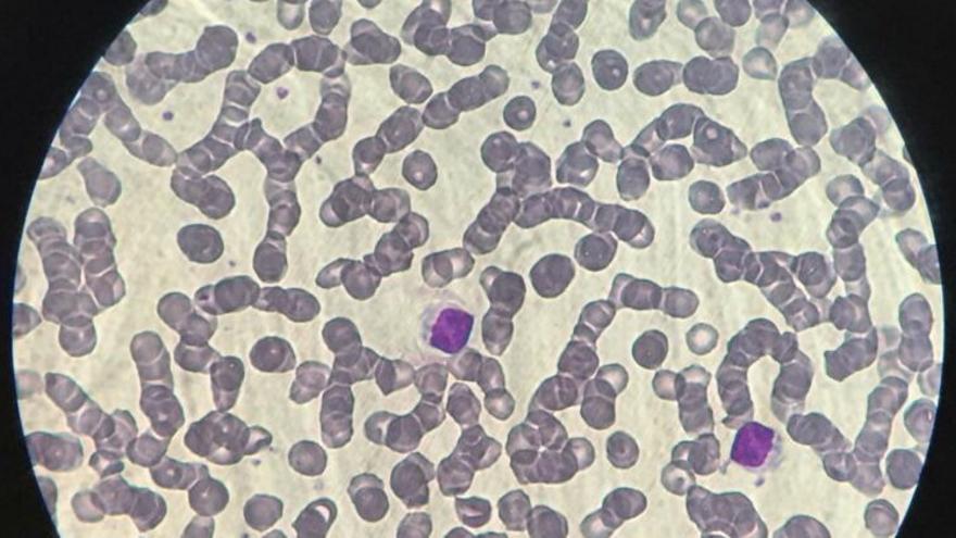 «Células T asesinas»: la gran esperanza contra las nuevas cepas del coronavirus