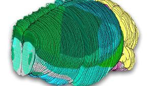 Imagen del cerebro de un ratón