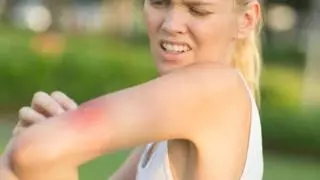 Paula Seiton, experta en limpieza: "Esta es la fórmula natural para decir adiós a los mosquitos usando ingredientes que tienes en casa"