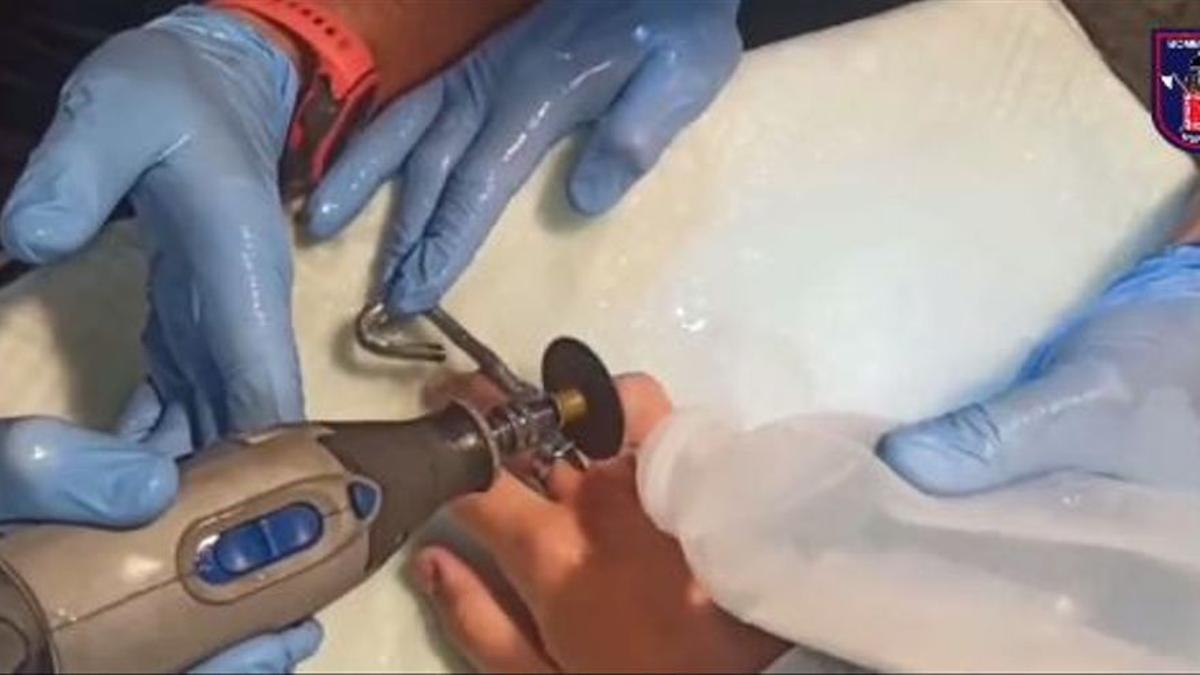 Los Bomberos y los sanitarios cortan un anillo a un joven.