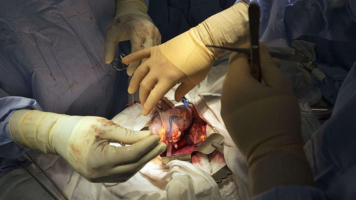 Médicos realizan un trasplante. |   // REUTERS