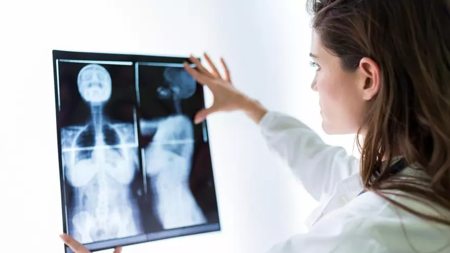 Primer 'atlas' de proteínas para pronosticar el cáncer de mama más agresivo