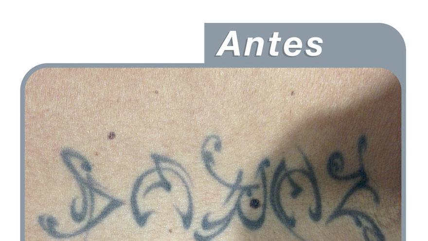 Adiós definitivo a los tatuajes