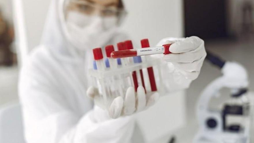 Aragón notifica 624 nuevos casos de coronavirus, 541 en la provincia de Zaragoza