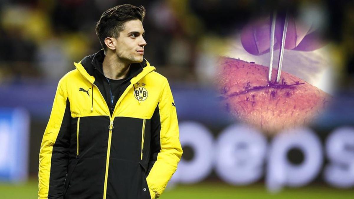 Marc Bartra se recupera de las secuelas del atentado