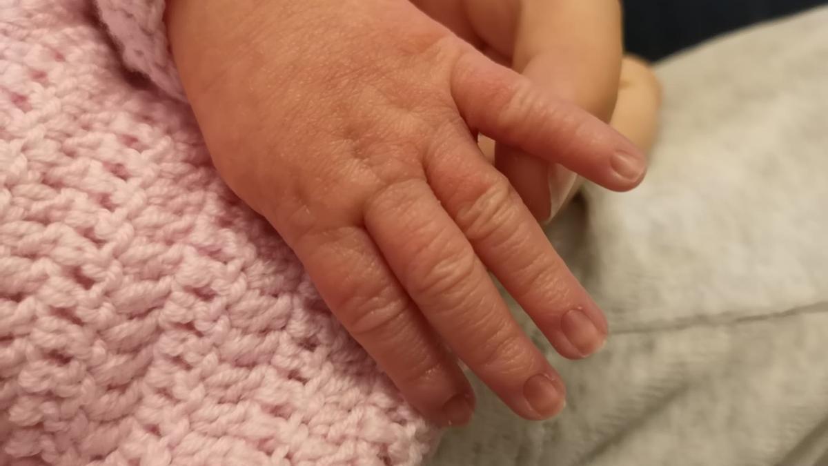 Una mano de un bebé, en una imagen de archivo.