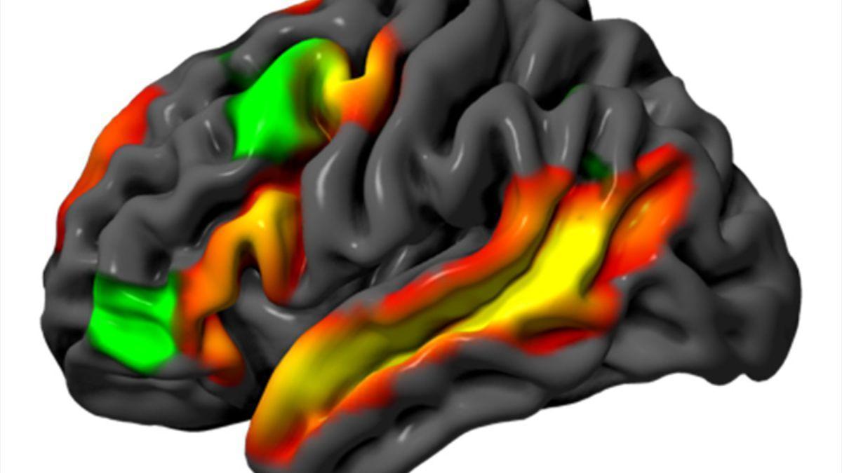 Las imágenes cerebrales muestran que la lógica y el pensamiento abstracto activan redes diferentes a las del habla.