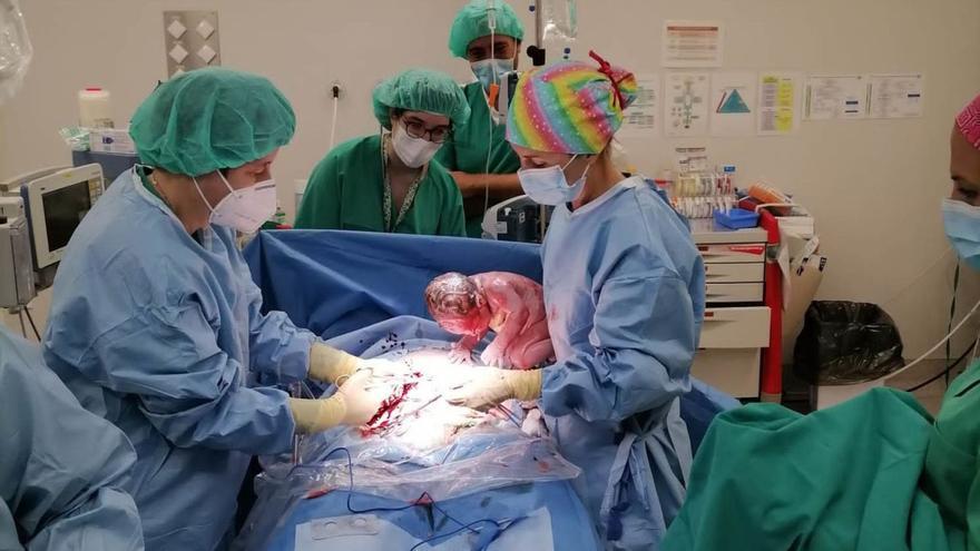 Una cesárea practicada en el hospital de Gandia. | LEVANTE-EMV