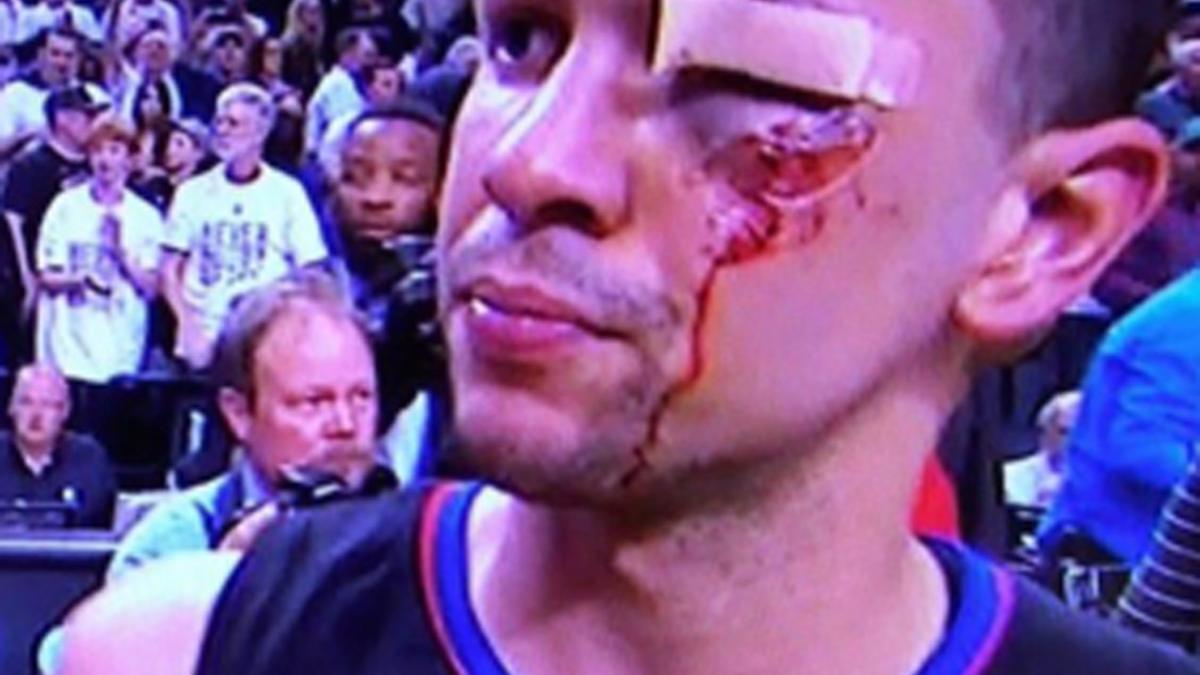 Austin Rivers, tras recibir el golpe de Aminu