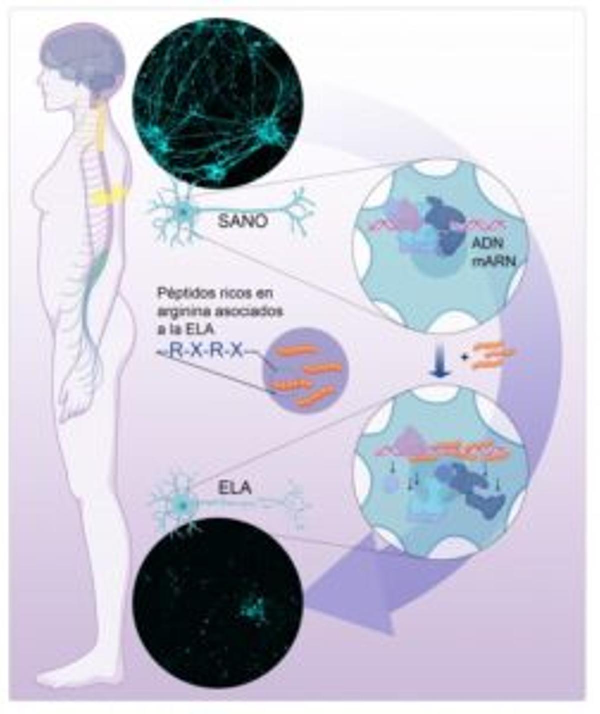 Descubren la causa de muerte neuronal en pacientes con ELA familiar