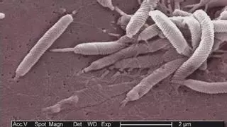 'Helicobacter pylori': estos son los síntomas de la bacteria que afecta a casi la mitad de la población y puede permanecer oculta durante años