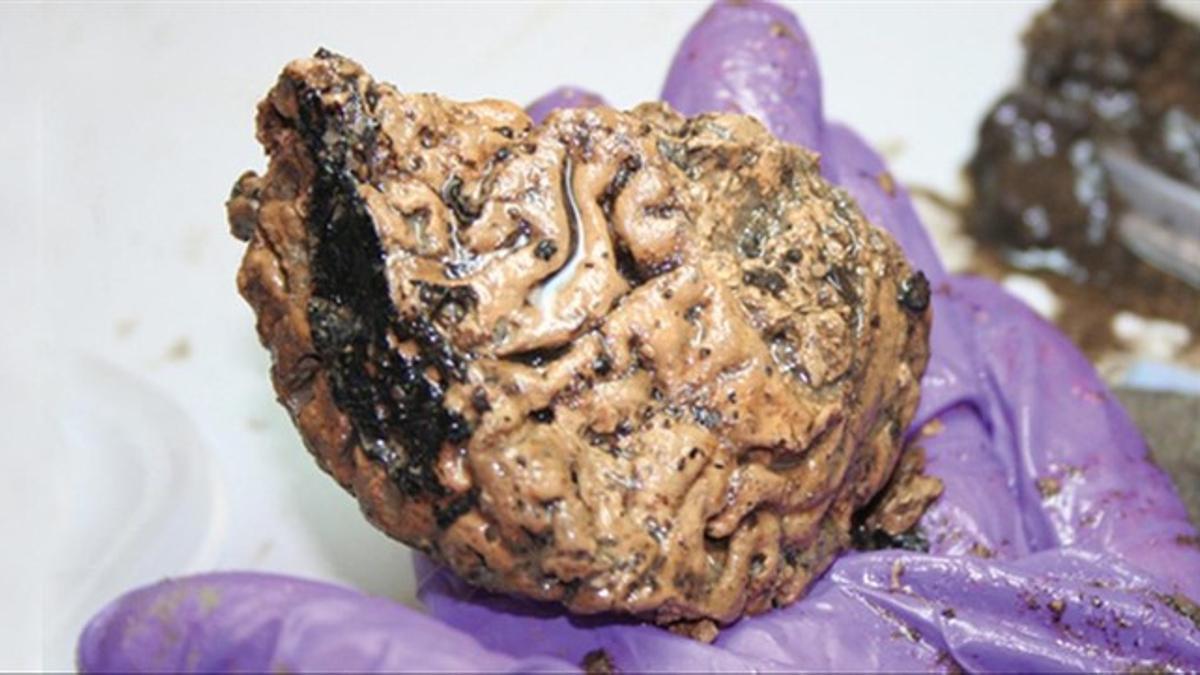 Cerebro de hace 2.600 años y muy bien conservado localizado por arqueólogos del York Archaeological Trust, en el Reino Unido.