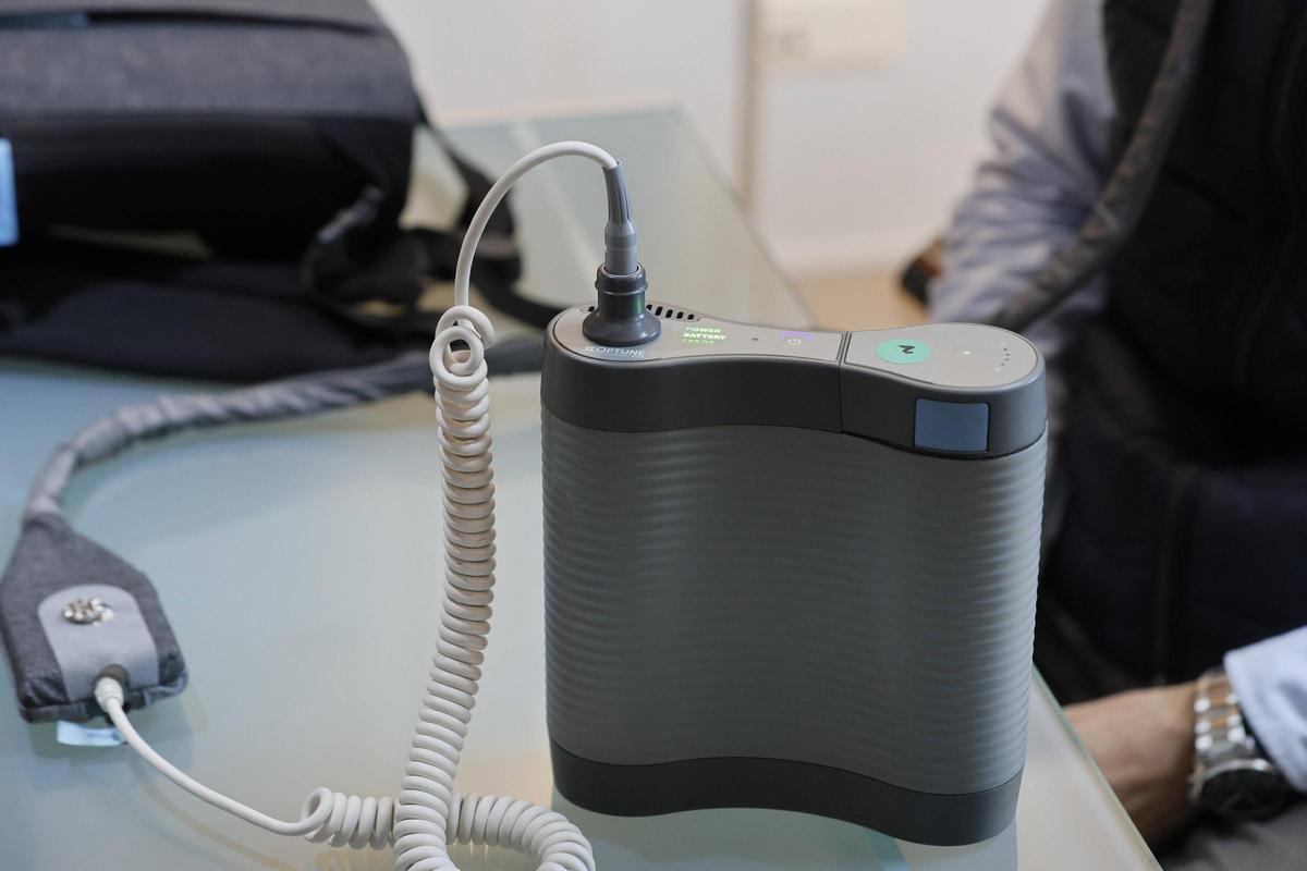 El dispositivo del TTFields, llamado Optune Gio, funciona creando campos eléctricos que actúan sobre las células tumorales.